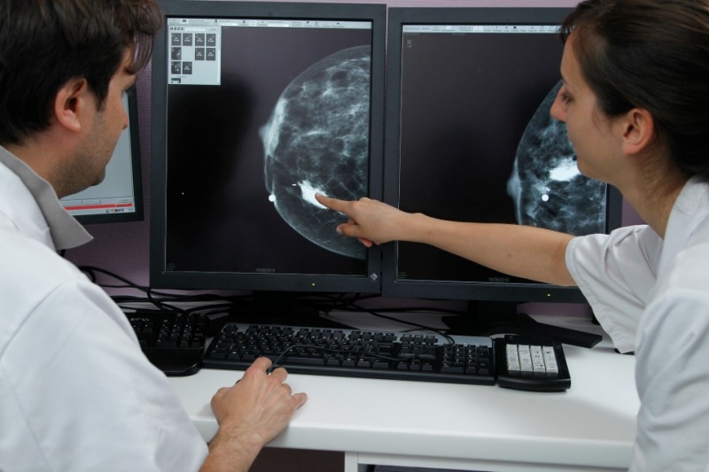 Przykładowe zdjęcie mammografii